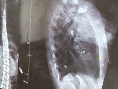 -张钰强中医正骨推拿连锁(华发商都店)