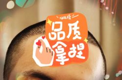 -大麦微针植发全国连锁