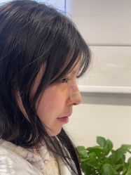 体验后-杭州美莱医疗美容医院