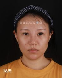 -北京米扬丽格医疗美容·联合丽格鼻整形中心