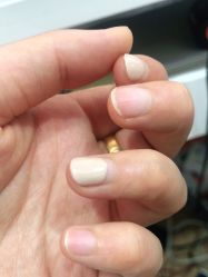 点击看大图 -美肌工坊皮肤管理