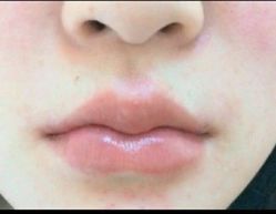 点击看大图 -SKINIST丽铂医疗美容