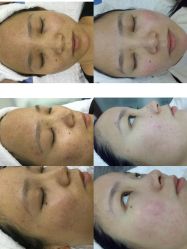 -Cream88颜皮肤管理中心