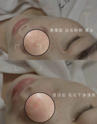 -美愈美肤MEIYU SKIN