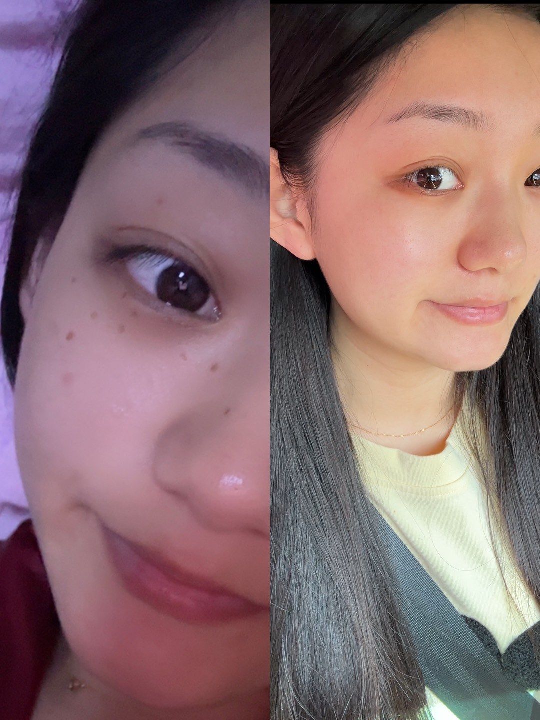 晒斑对我不可怕 对大家挺可怕