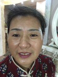 点击看大图 -郡艺医疗美容·微整·眼鼻吸脂