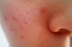 -成都军建医院·疤痕诊疗中心