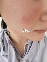-奥拉克（天津）医疗美容门诊