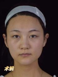 -Yestar重庆艺星医疗美容医院