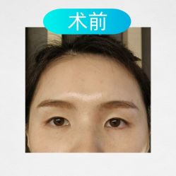 -素美医疗美容·西南眼鼻整形·修复基地