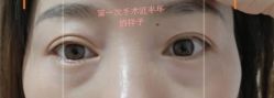 -上海时光整形外科医院