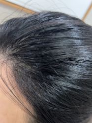 -熙朵美学植发·连锁品牌