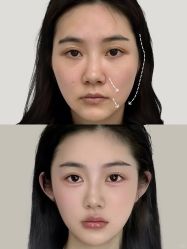 -上海伊莱美医疗美容医院