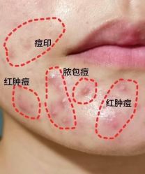 点击看大图 -MLP美丽派·问题肌疗愈中心