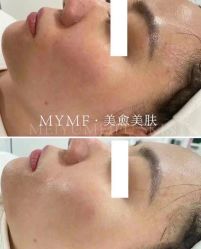 -美愈美肤MEIYU SKIN