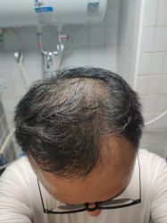 -唐风采假发补发定制