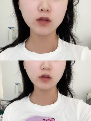 -亿美医疗美容·半岛大超炮官方授权店