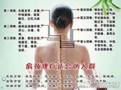-香薇妮丝女子减肥院
