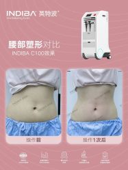 -半岛故事·法儿曼抗衰·indiba中心