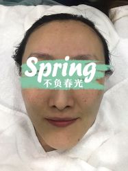 体验后-坤如玛丽·医疗美容中心