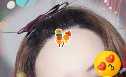 -大麦微针植发全国连锁