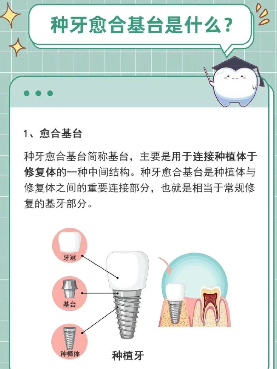 种牙愈合基台是什么?