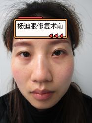 -素美医疗美容·西南眼鼻整形·修复基地