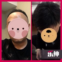 点击看大图 -乐绅男士高端假发定制