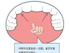 -团圆口腔·种植中心(锦江院区)