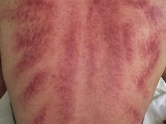 -逸栈养生SPA(望京店)