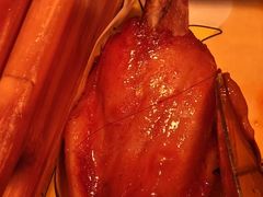 -深海聚汇·牛榴宴·自助料理(江宁万达店)