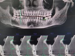 -同步齿科·数字化正畸种植口腔中心(珠海店)