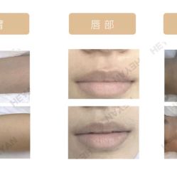 -HEYAN荷妍专业脱毛连锁机构