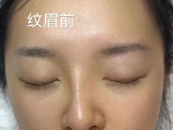 -德绣·机器野生眉发际线·美瞳线半永久