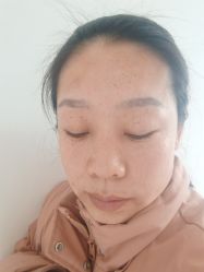 -AiCure 埃可儿·韩国医学皮肤管理