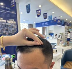 -大麦微针植发全国连锁