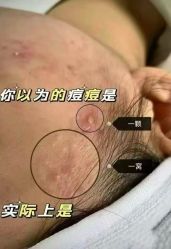 点击看大图 -MLP美丽派·问题肌疗愈中心