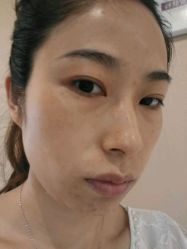 android_upload_pic-哈尔滨瑞丽医疗美容医院
