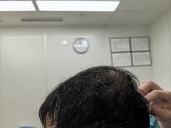 点击看大图 -熙朵美学植发·连锁品牌