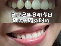 -优诺口腔(华东总院)