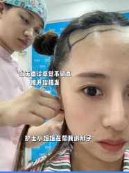 -雍禾植发全国连锁