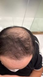 -发饰美男士增发补发假发定制店