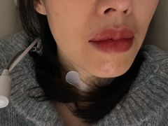 -爱氧森林·日本兴百世SHENPIX微高压氧舱