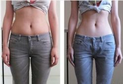 光SPA热力塑-光SPA科技美肤