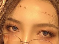 -黑马眼科·近视手术