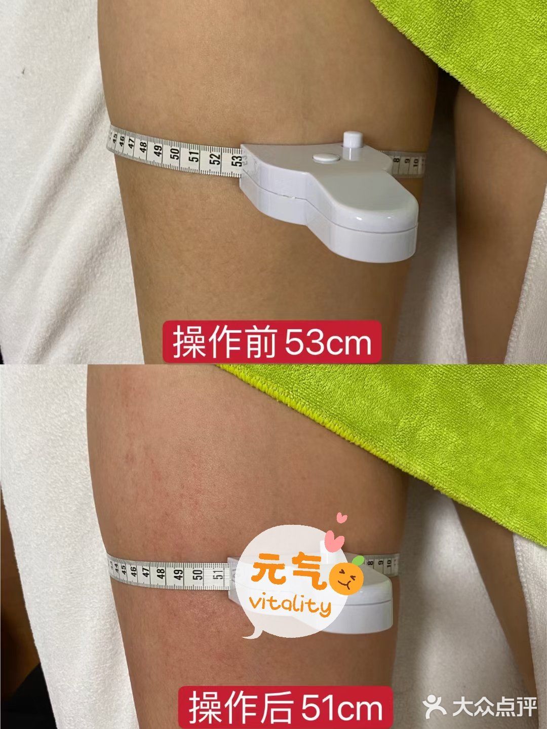 效果杠杠哒💯💯💯