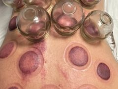 -安琪盲人按摩调理草本熏蒸馆(风和日丽店)