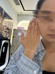 体验前-联合丽格·张菡丽格医疗美容