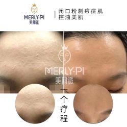 -MLP美丽派·问题肌疗愈中心