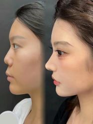 -上海伊莱美医疗美容医院
